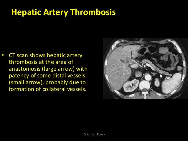 Imaging in Transplantation